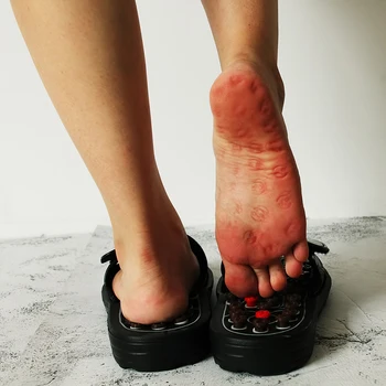 Acupoint Masážne Papuče Pre Mužov, Ženy Sandále Nohy Čínska Akupresúra Liečba Lekárske Otáčanie Nohy Masér Unisex Topánky